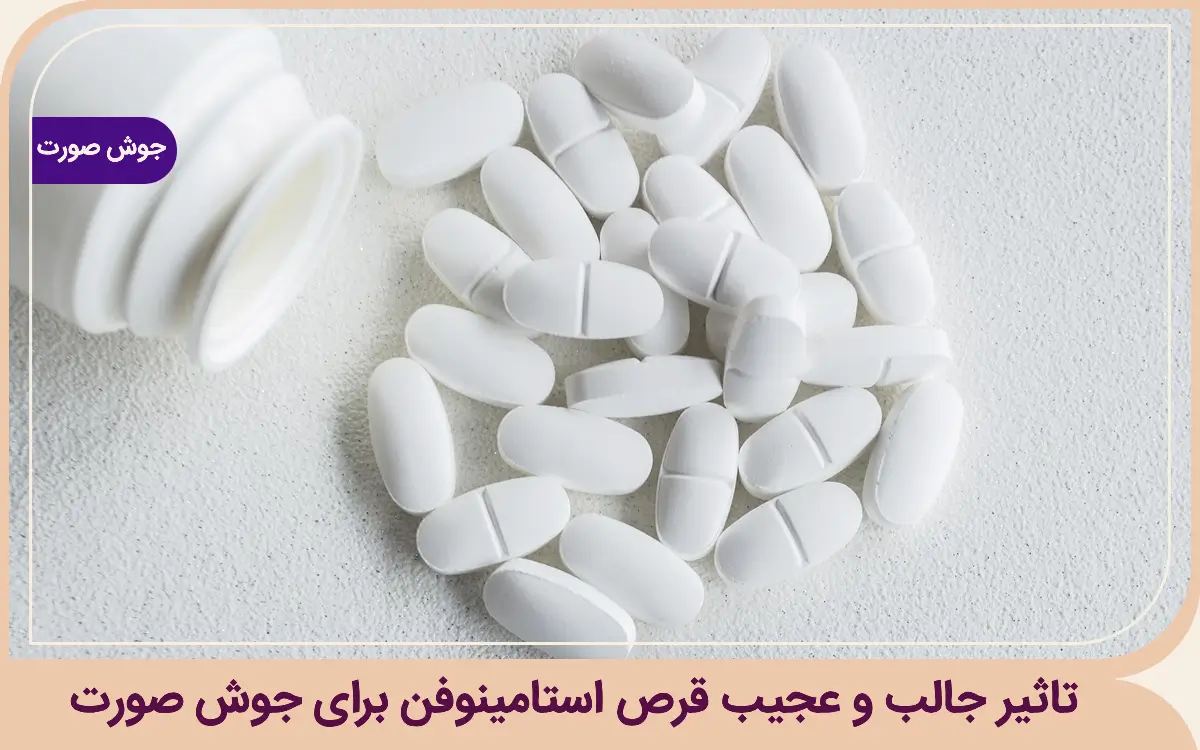 تاثیر جالب و عجیب قرص استامینوفن برای جوش صورت