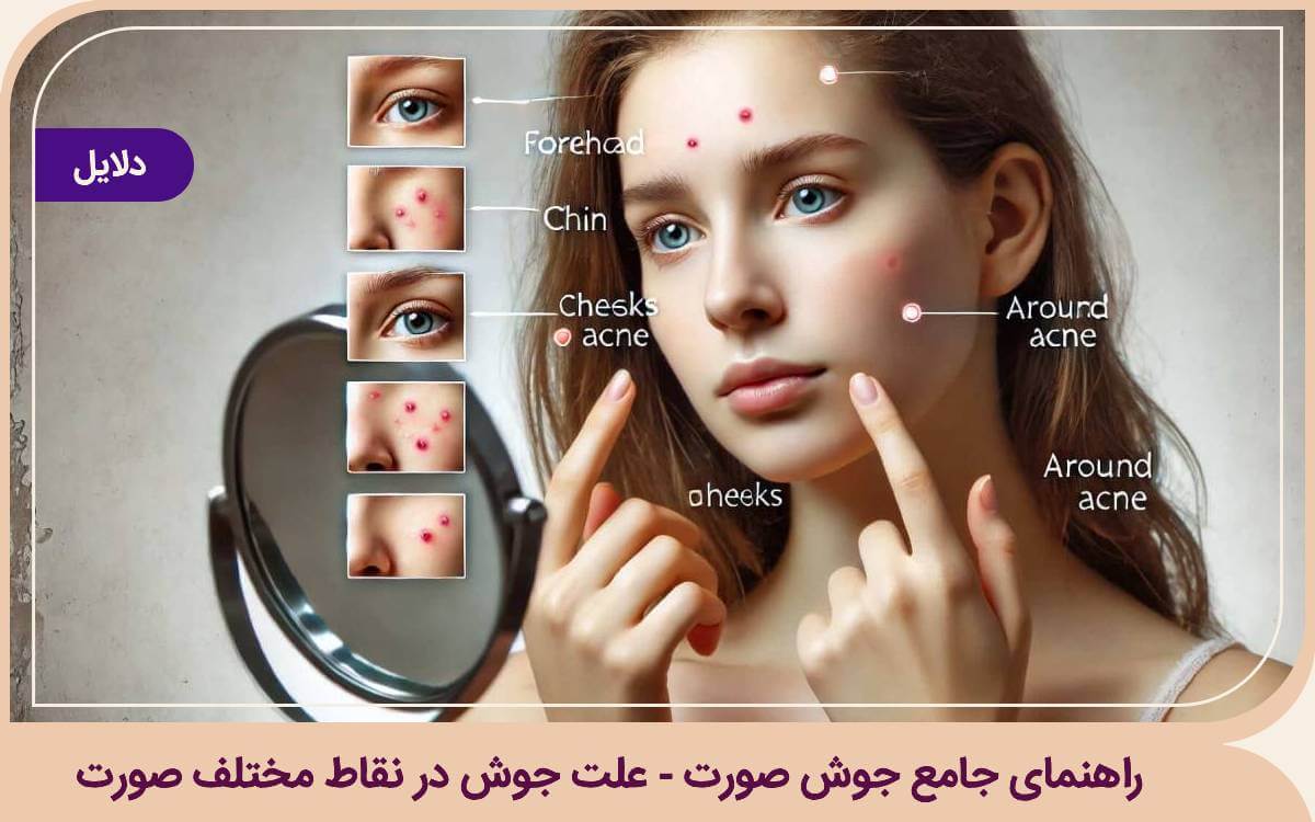 علت جوش در نقاط مختلف صورت