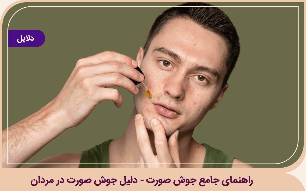دلیل جوش صورت در مردان چیست