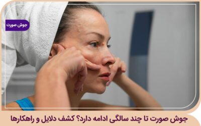 جوش صورت تا چند سالگی ادامه دارد؟ کشف دلایل و راهکارها جوش صورت تا چند سالگی ادامه دارد