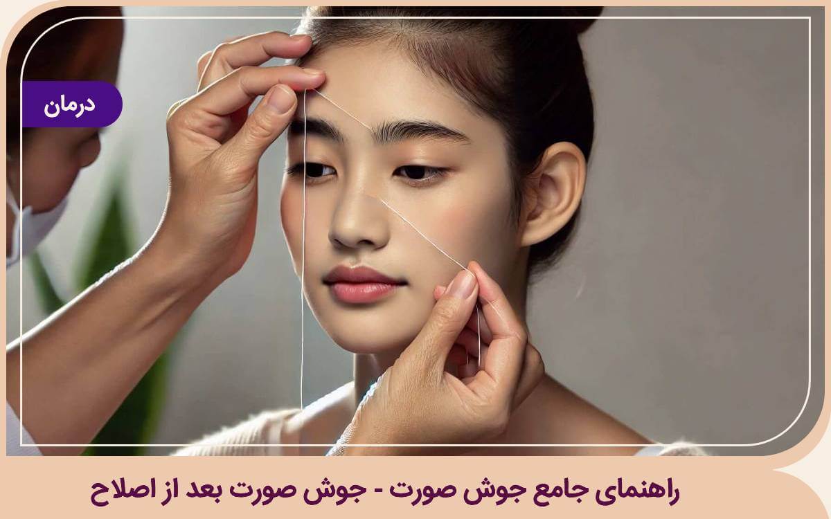 جوش بعد از اصلاح