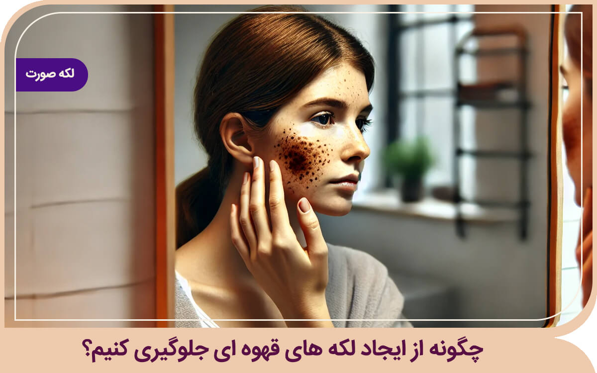 علت لکه های قهوه ای روی صورت علت لکه های قهوه ای روی صورت