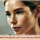 علت لکه های قهوه ای روی صورت چیست