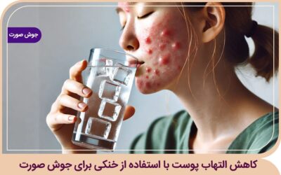 خنکی برای جوش صورت