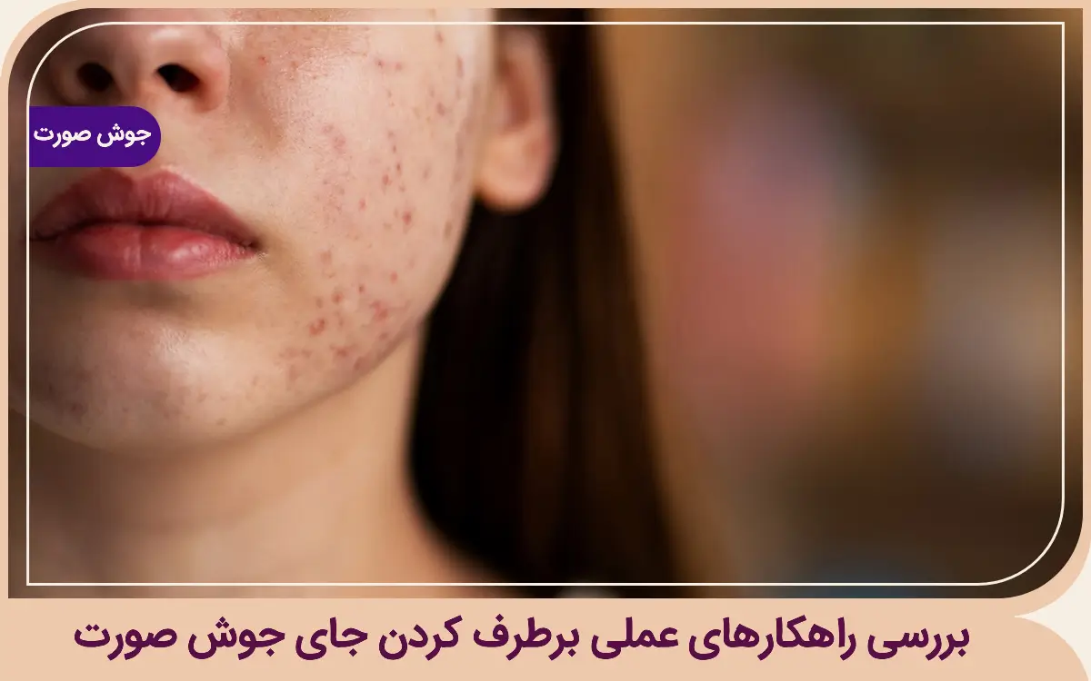 بررسی راهکارهای عملی برطرف کردن جای جوش صورت