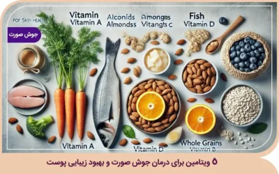 چه ویتامینی برای جوش صورت خوب است؟ ویتامین برای درمان جوش صورت