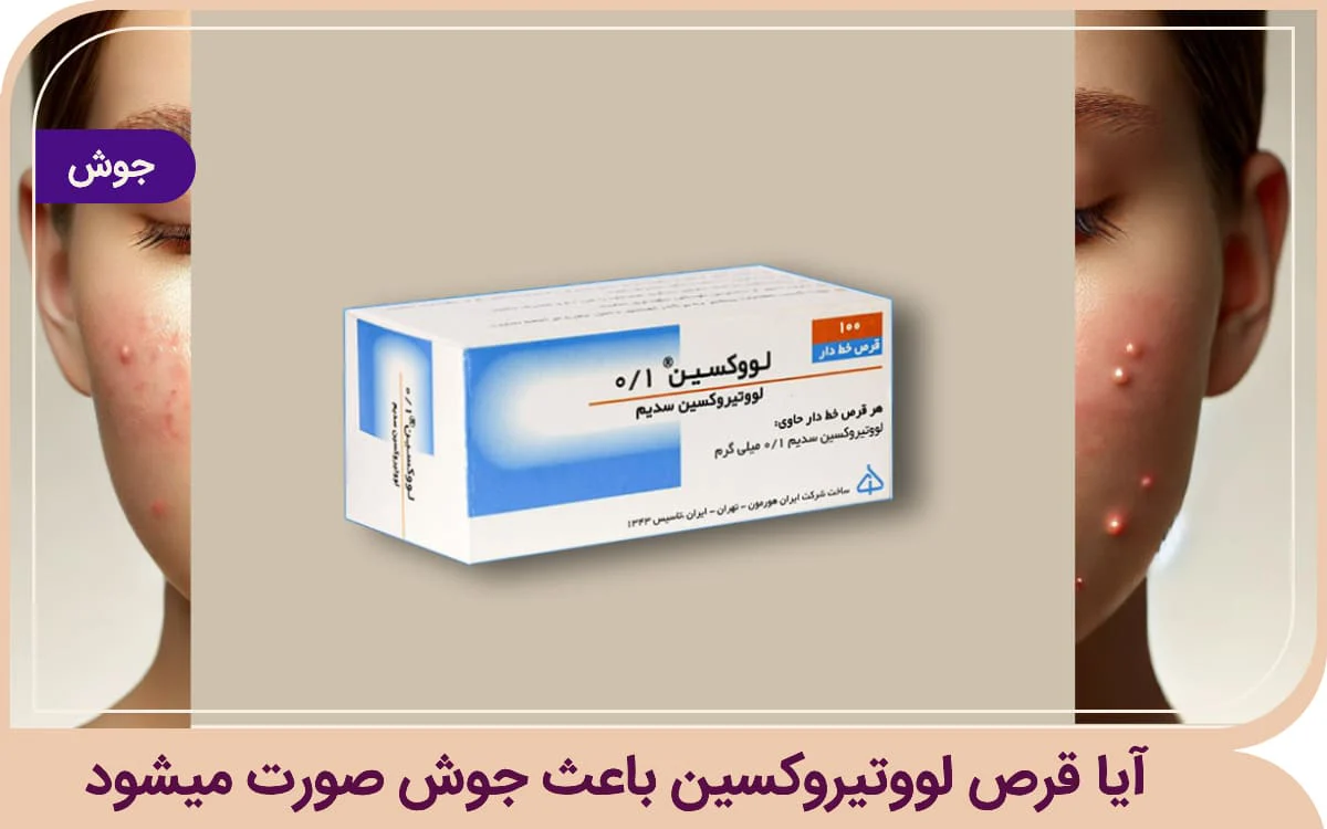 آیا قرص لووتیروکسین باعث جوش صورت میشود