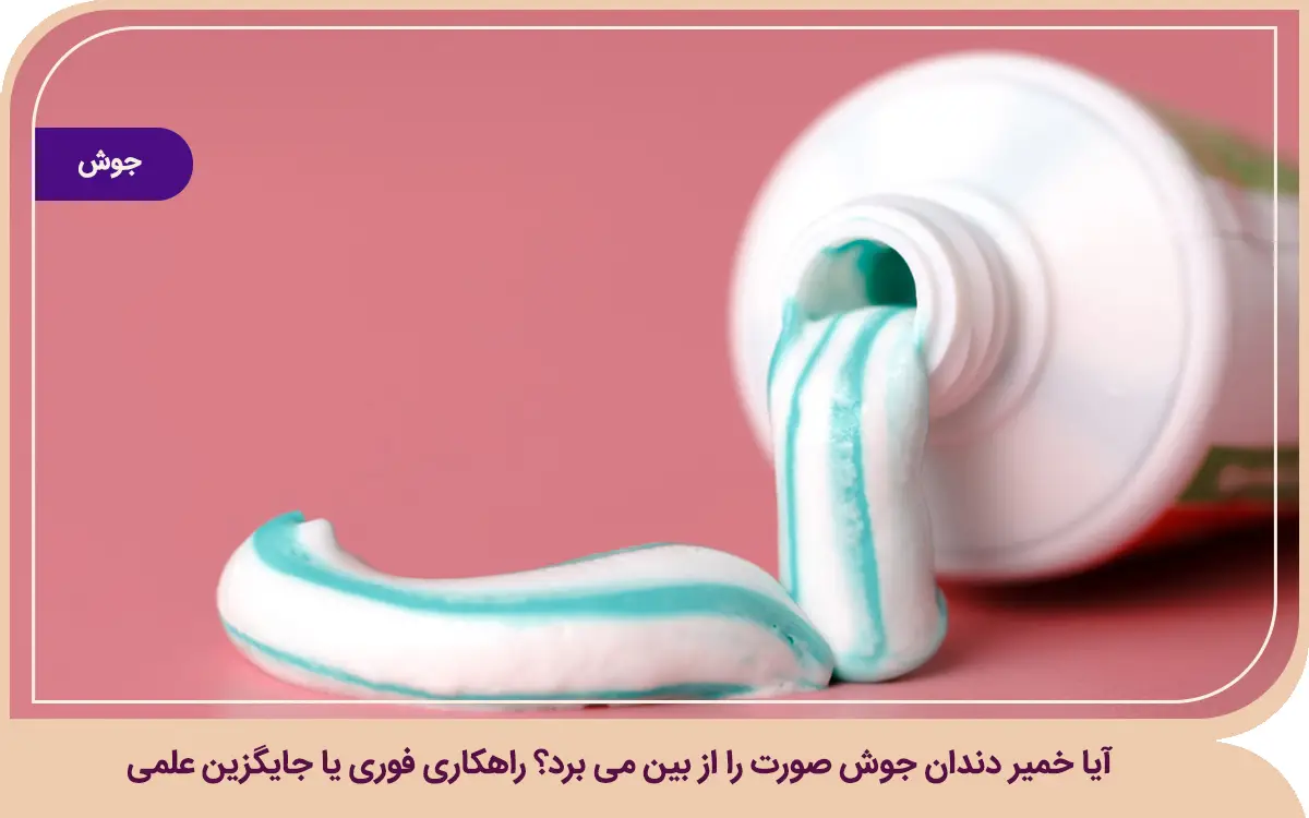 آیا خمیر دندان جوش صورت را از بین می برد
