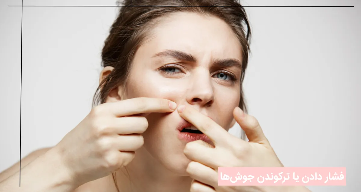 فشار دادن یا ترکوندن جوش‌ها