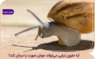 آیا حلزون تراپی میتواند جوش صورت را درمان کند؟ حلزون تراپی برای جوش صورت