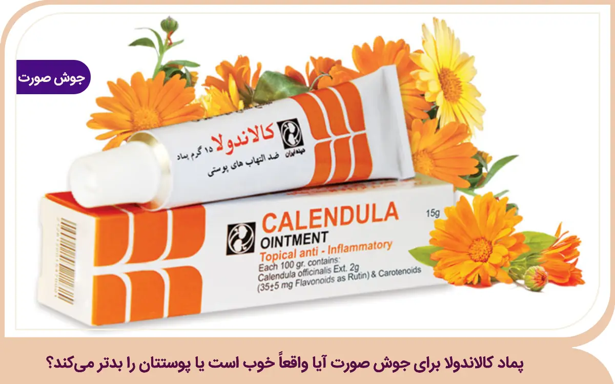پماد کالاندولا برای جوش صورت