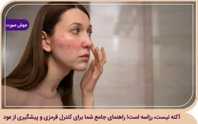 آکنه نیست، رزاسه است! راهنمای جامع شما برای کنترل قرمزی و پیشگیری از عود رزاسه