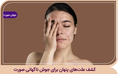 کشف علتهای پنهان برای جوش ناگهانی صورت جوش ناگهانی صورت
