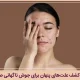 جوش ناگهانی صورت