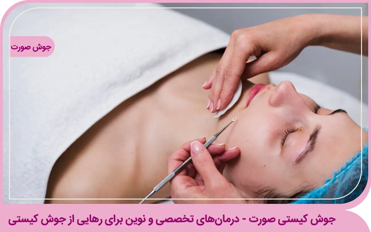 درمان‌های تخصصی جوش کیستی