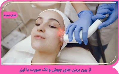 از بین بردن جای جوش با لیزر
